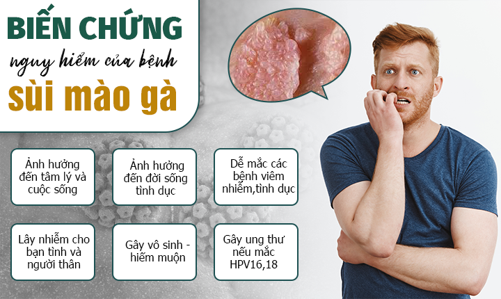 Bệnh sùi mào gà: Nguyên nhân, triệu chứng và cách điều trị hiệu quả