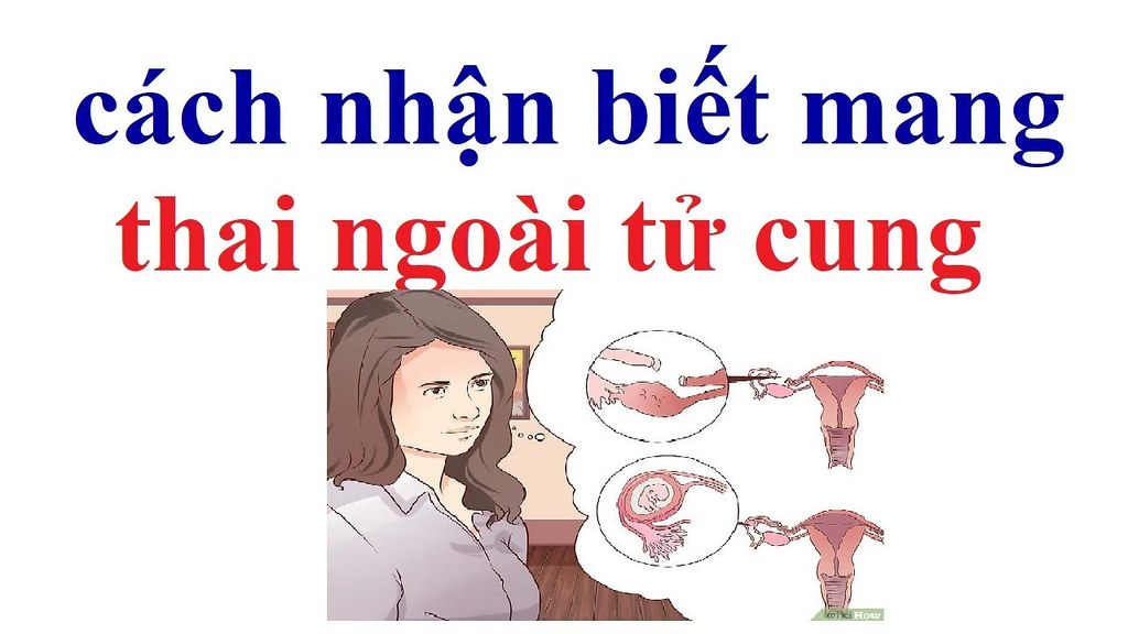 Chửa Ngoài Tử Cung Là Gì? Những Điều Cần Biết